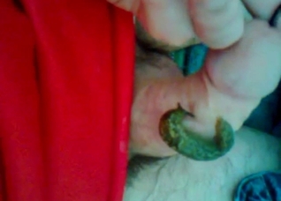 Dude dealing with worms and slugs, all at once